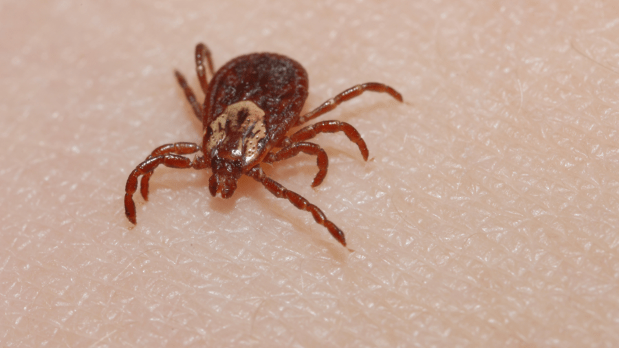 tick bite