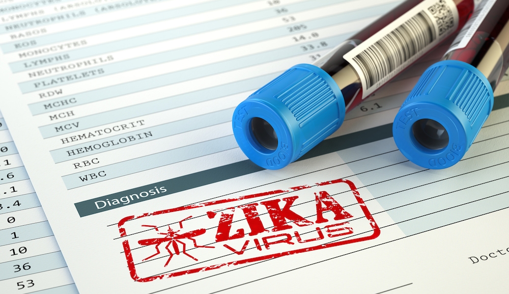 Latest Development in Zika Virus: Brain Damage in Adults